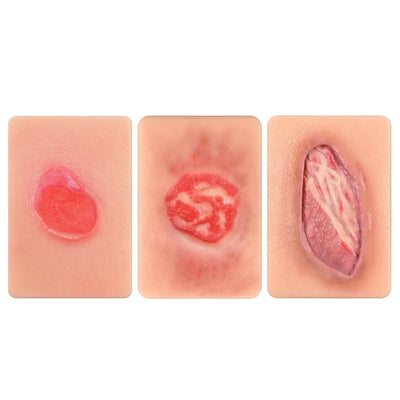 Stage 2-4 Pressure Ulcer Wound Simulation Model