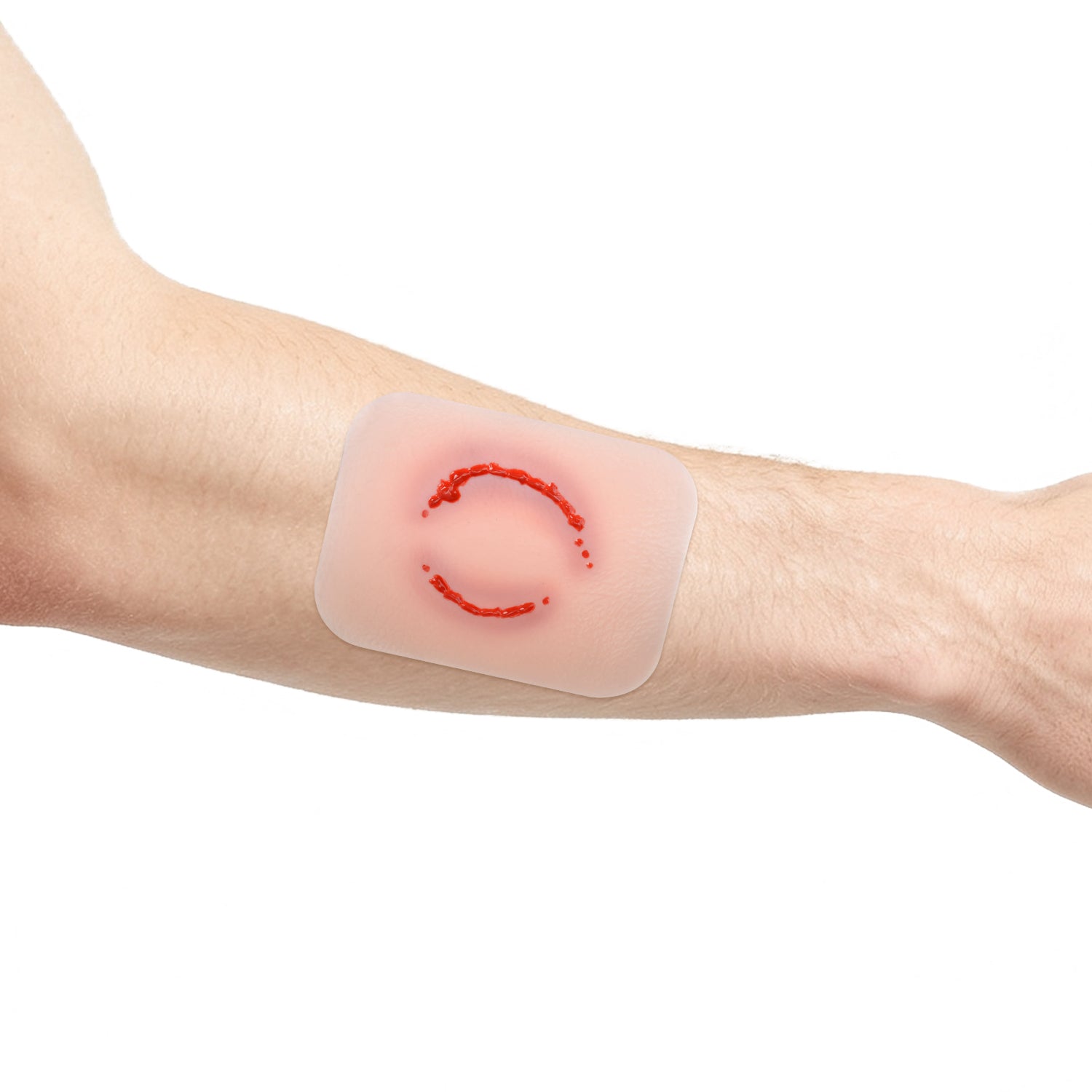 Sticky Human Bite Wound Moulage