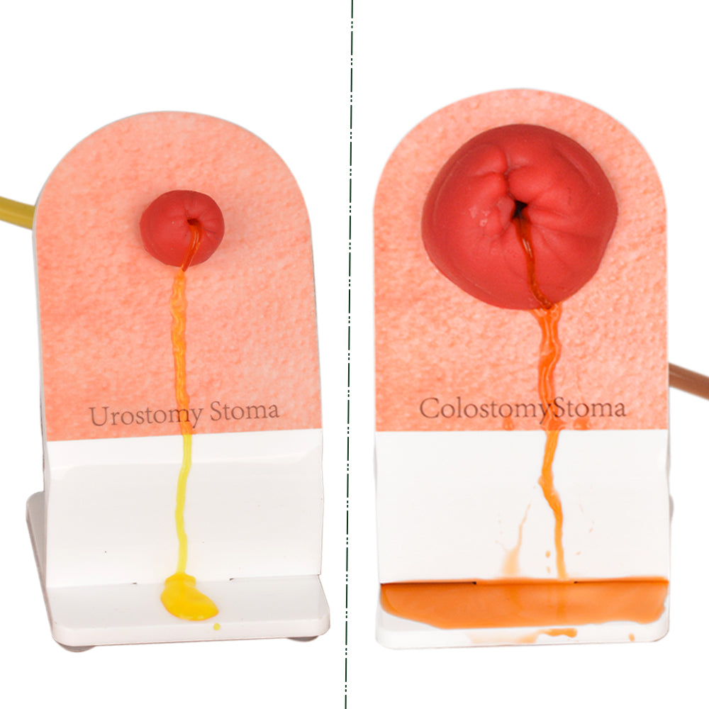 Stoma Care Trainers with Simulated Stoma Output