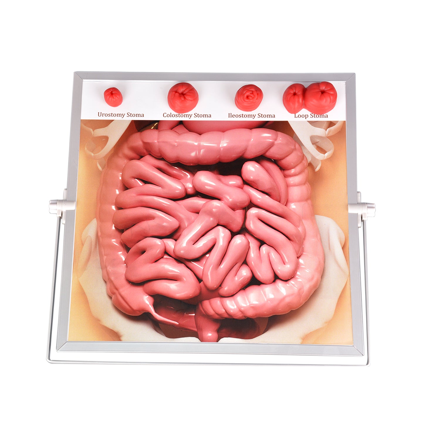 Stoma Trainer for Nursing Education and Patient Training