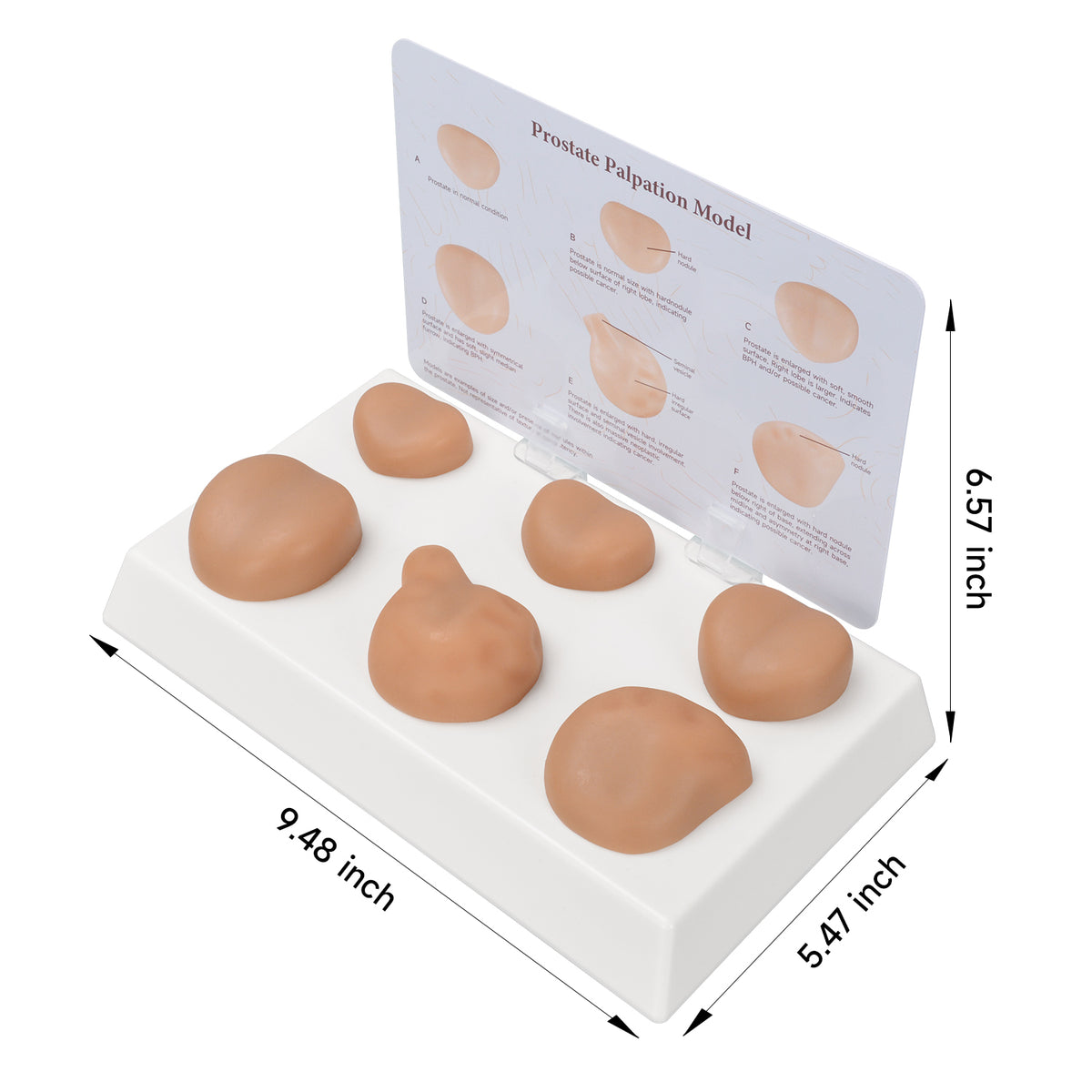 Prostate Scale Model Prostate Palpation Education Model for DRE Training – Medarchitect