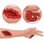 The Laceration and Severed Finger Wounds Detail on Arm