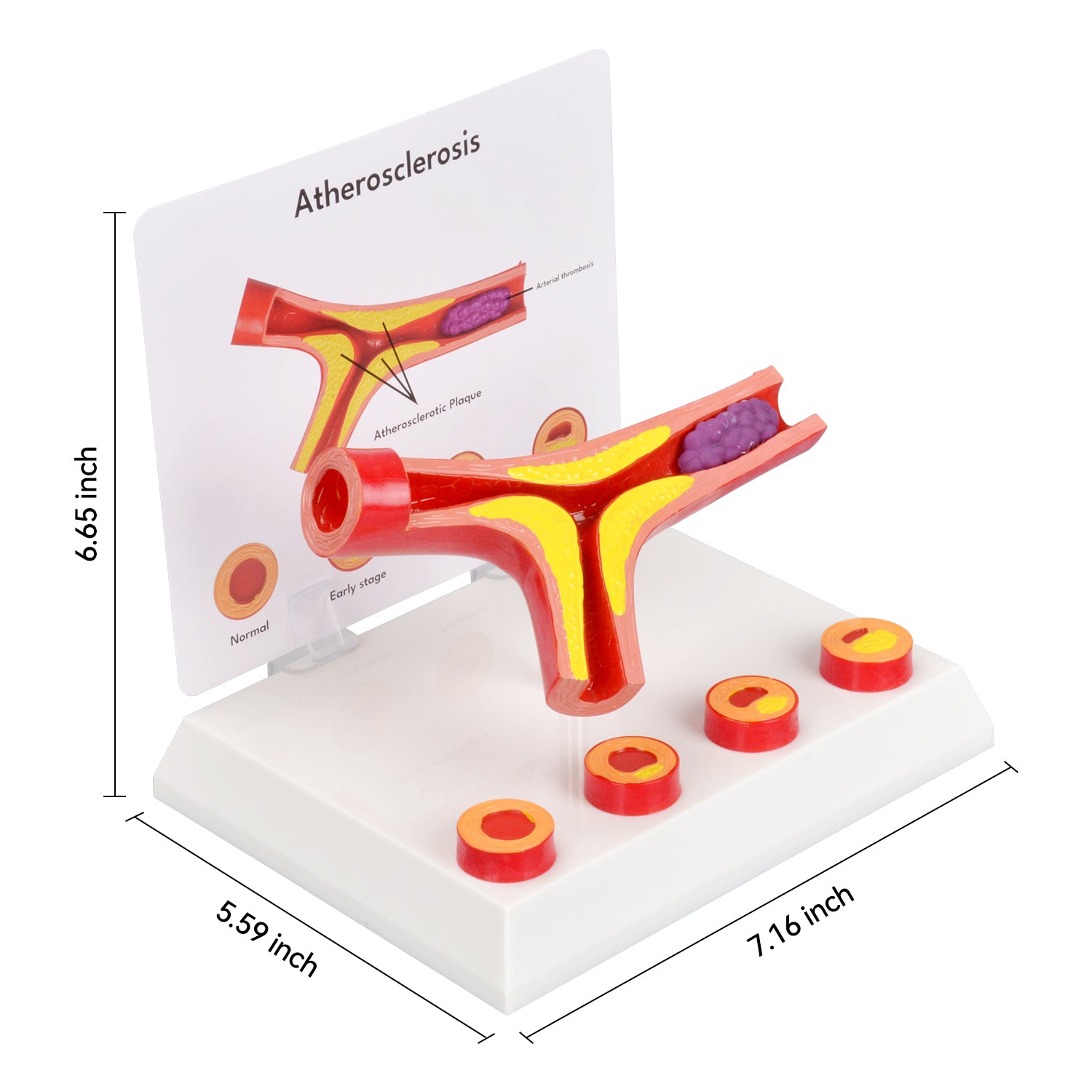 The Size Info of Atherosclerotic Vascular Anatomical Model