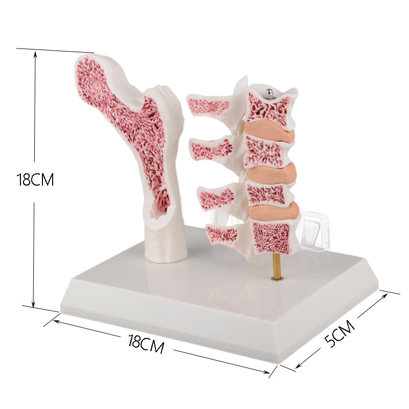 The Size Info of Osteoporosis Anatomy Model