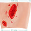 Thigh Trauma Training Model Size