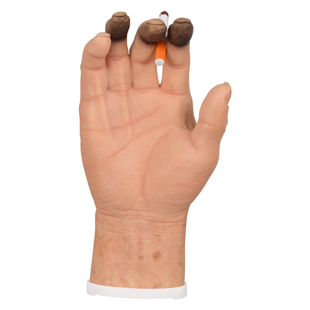 Tobacco Education Hand Model