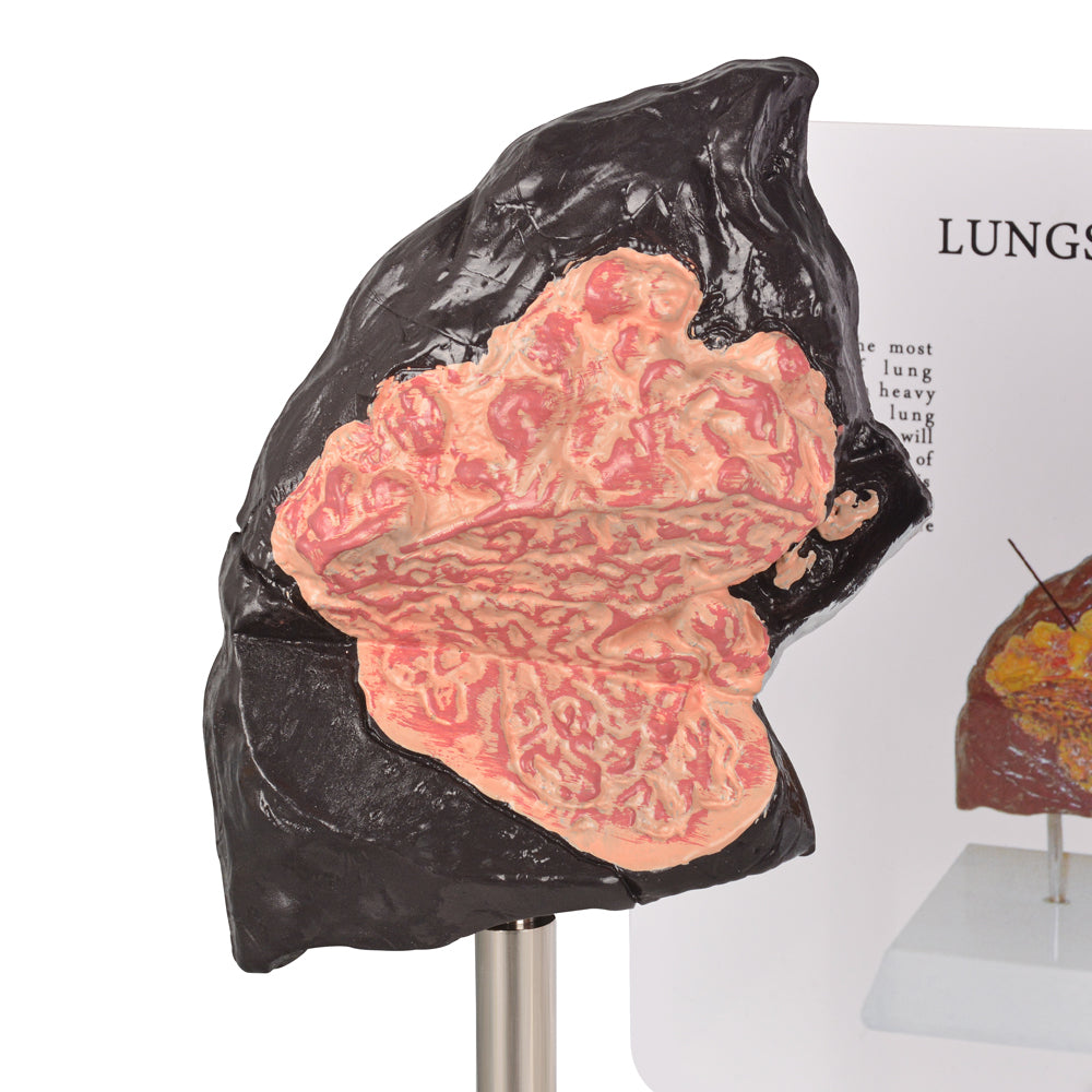 Tobacco Education Lung Model