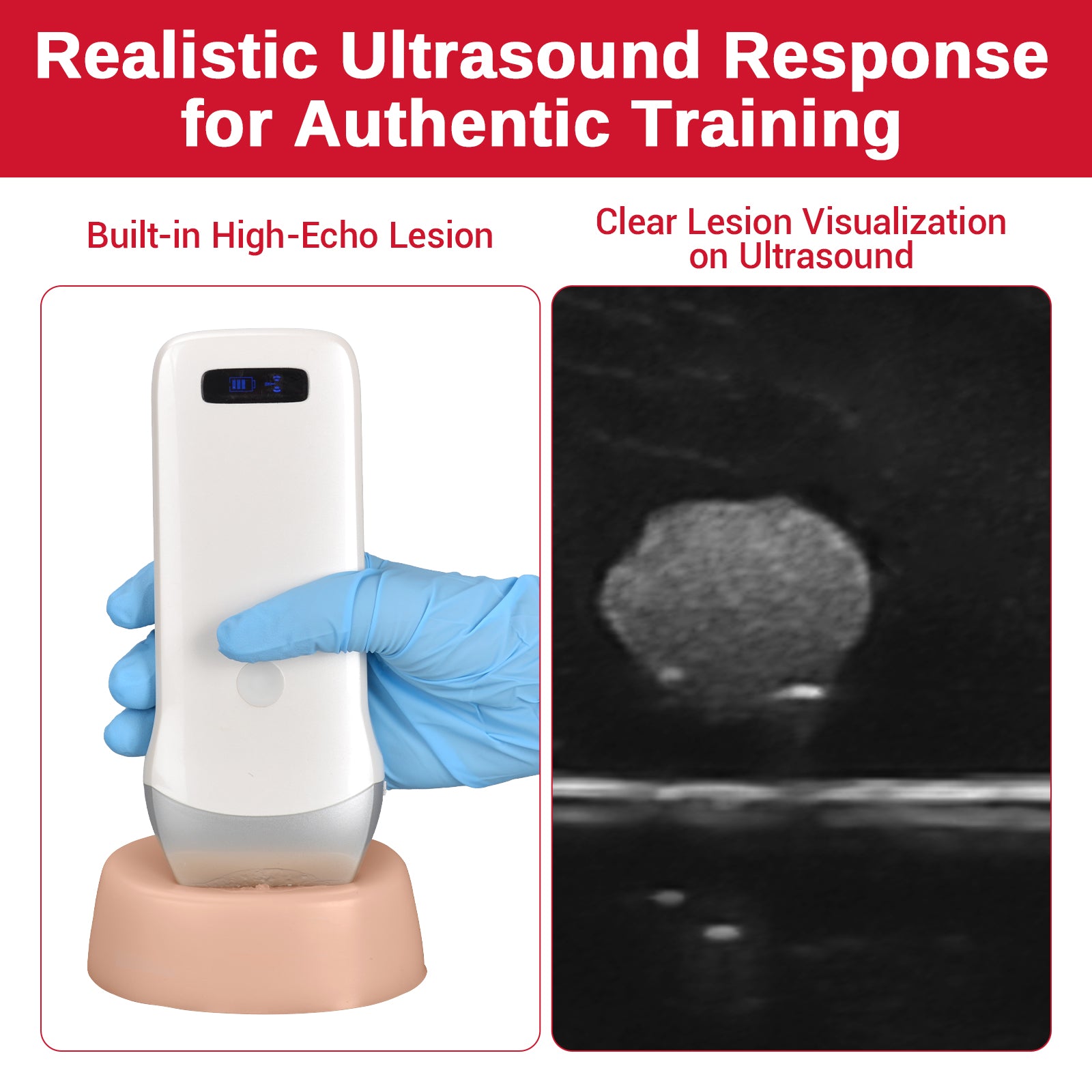 Ultrasound Guided Biopsy Phantom