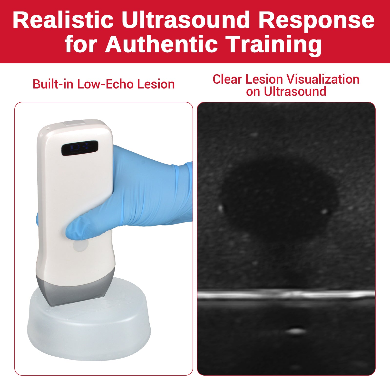 Ultrasound Guided Biopsy Phantom