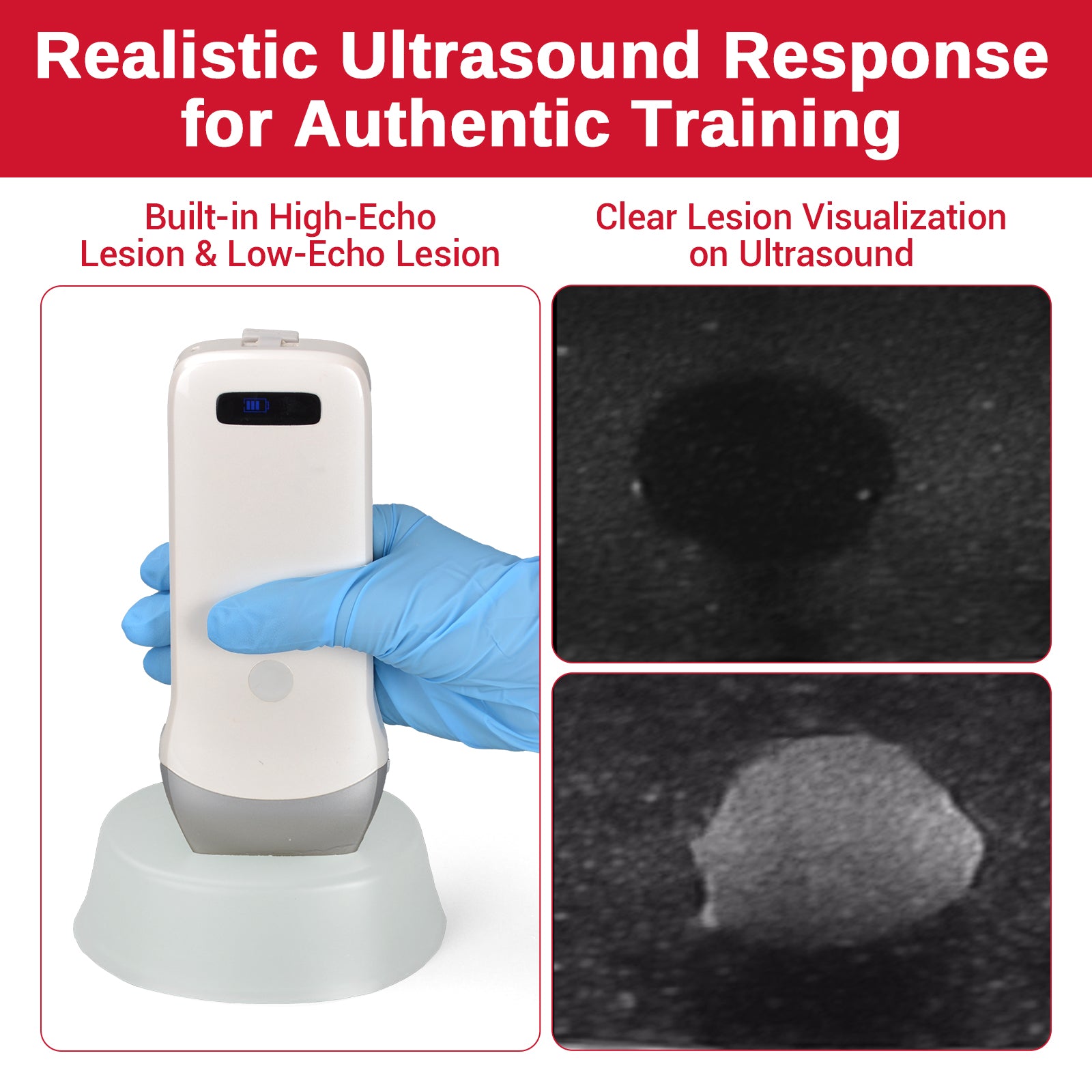 Ultrasound Guided Biopsy Training Phantom with Dual Lesion Simulation