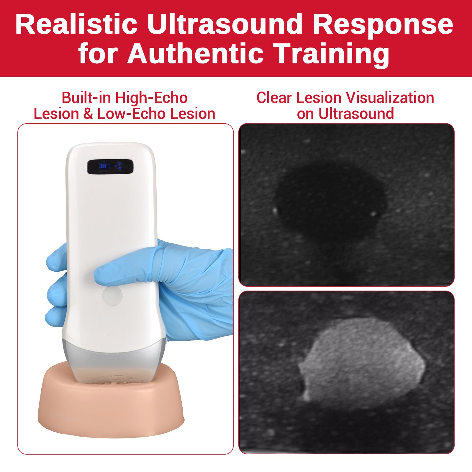 Ultrasound Guided Biopsy Training Phantom with Dual Lesion Simulation