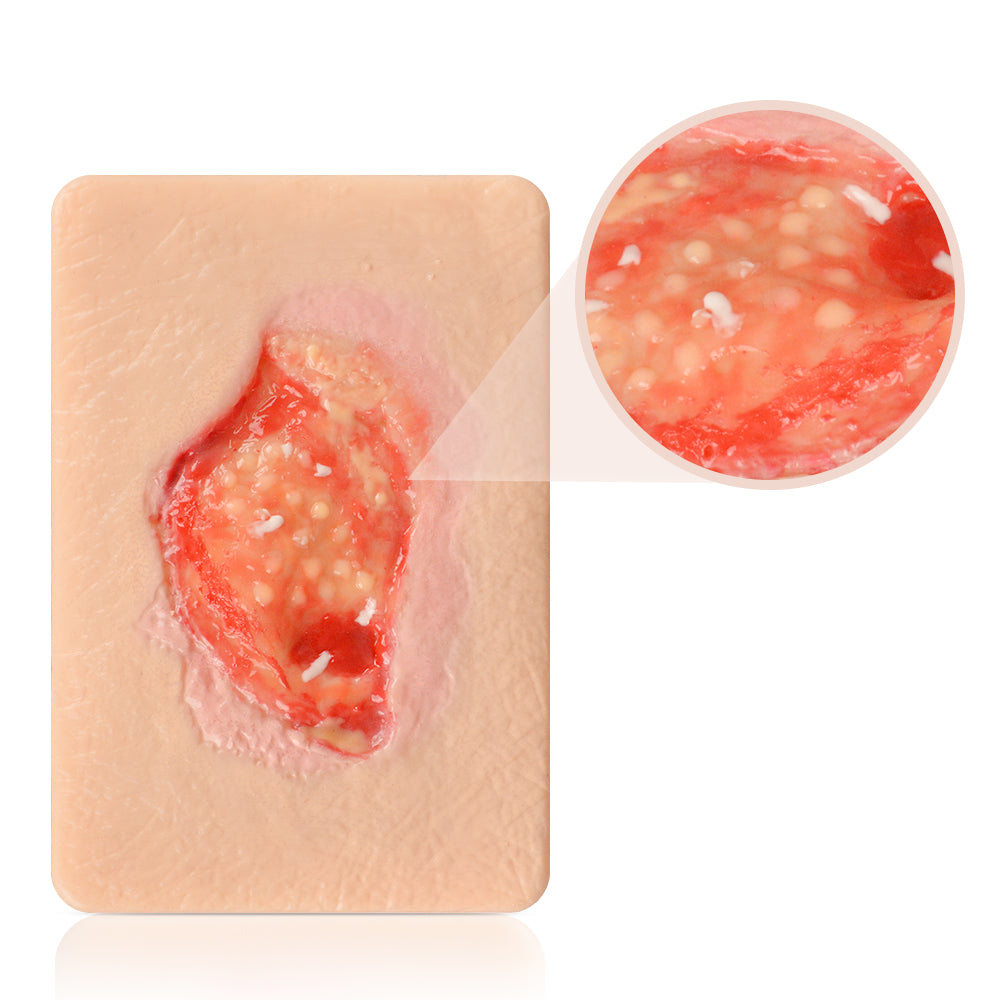 Unhealthy Granulation Tissue Simulation Model