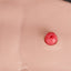 Urostomy Stoma Model