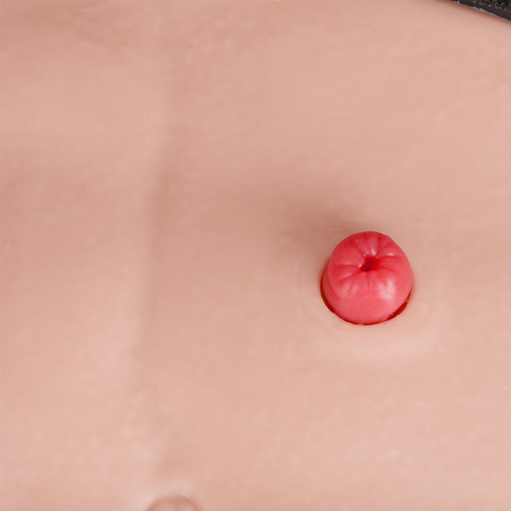 Urostomy Stoma Model