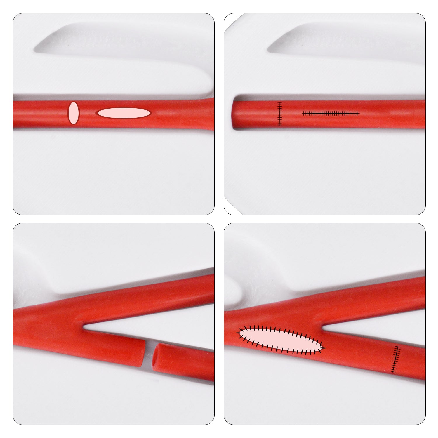 Vascular Reconstruction And Anastomosis Simulation Training Kit