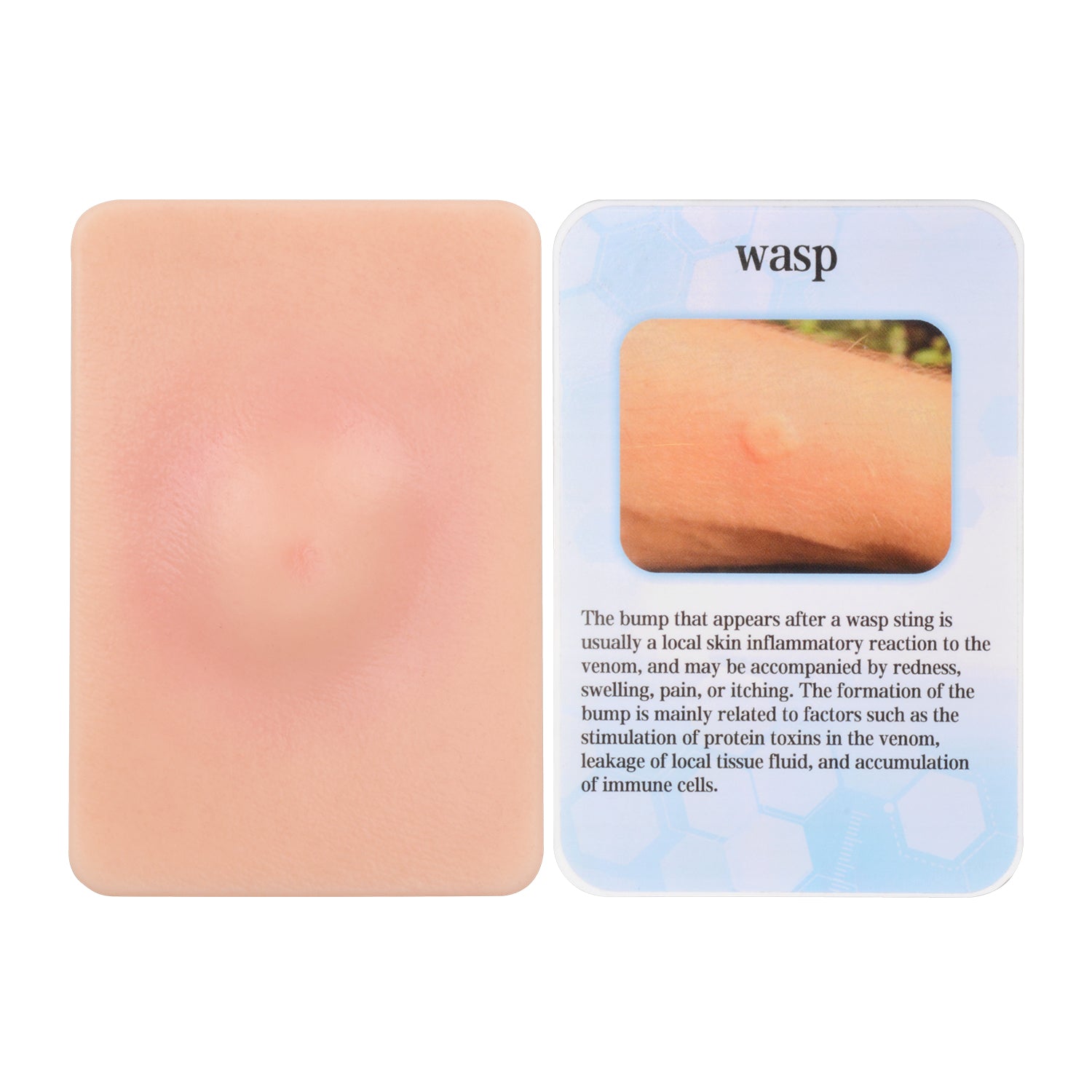 Wasp Sting Injury Simulation Model