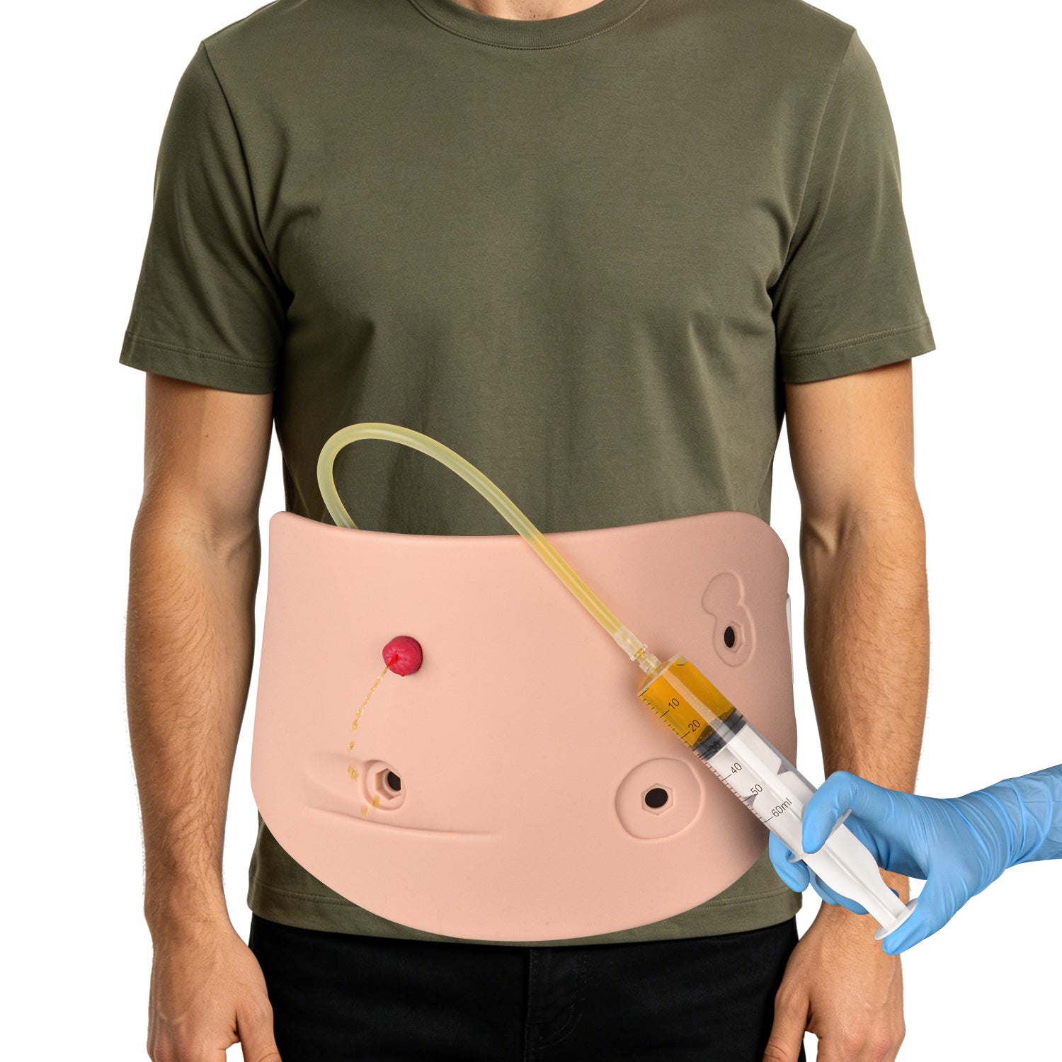 Wearable Multi-Stoma Ostomy Care Trainer Kit