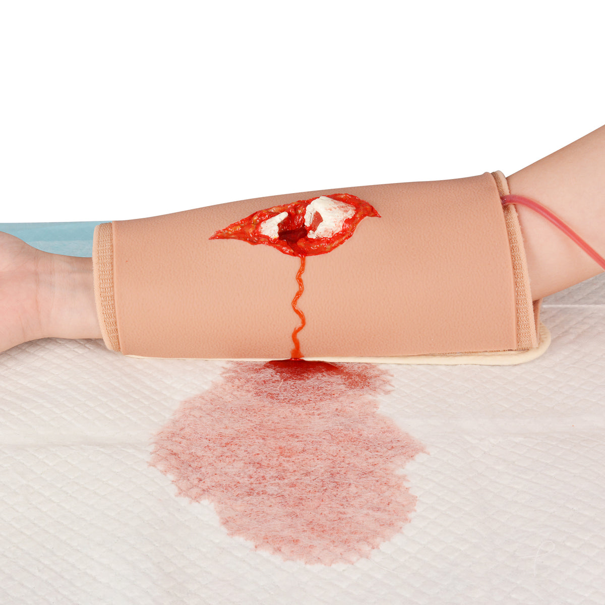 Traumatic Open Fracture Injury Training Model (Grade II–V) – Medarchitect