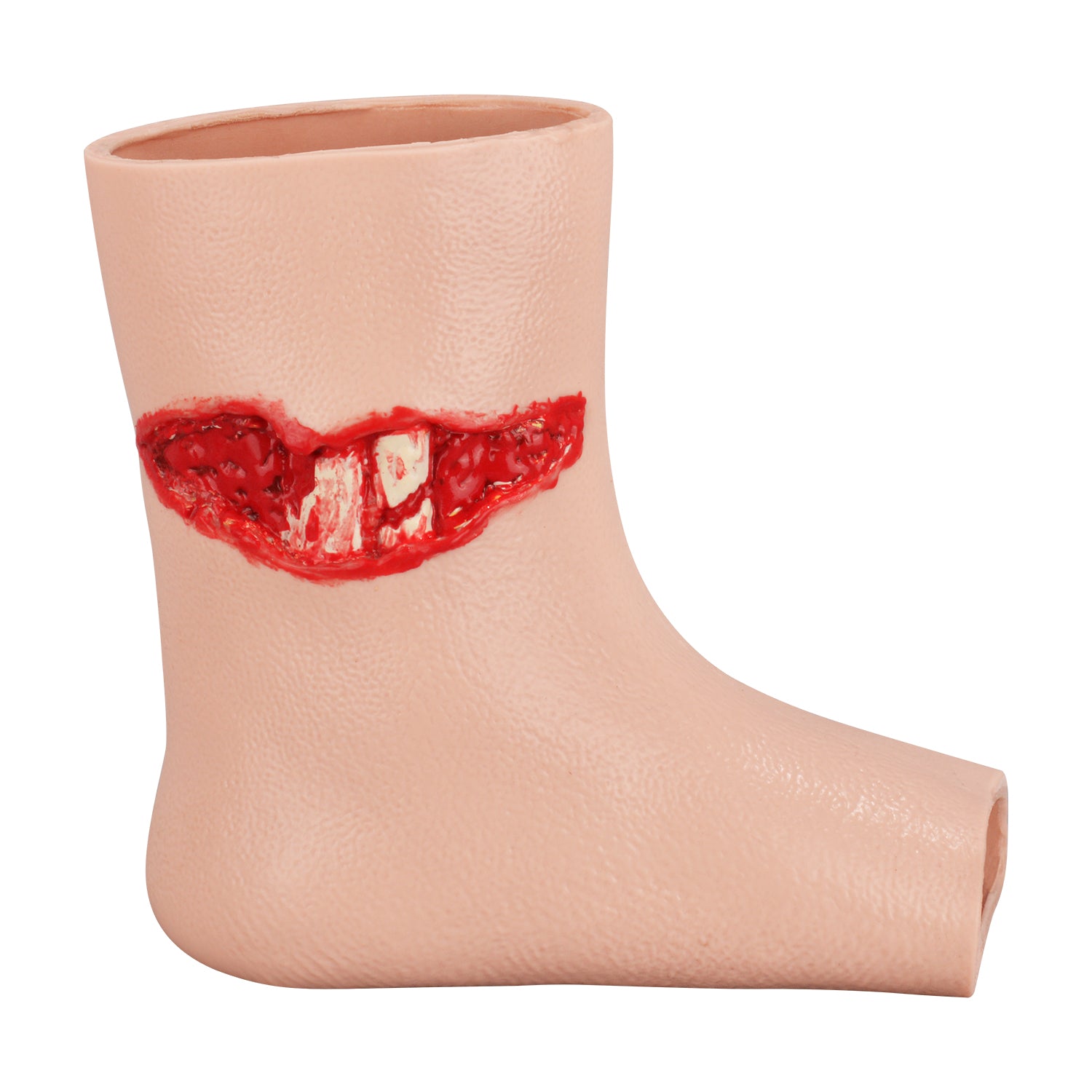 Wound Care And Fracture Management Practice Model