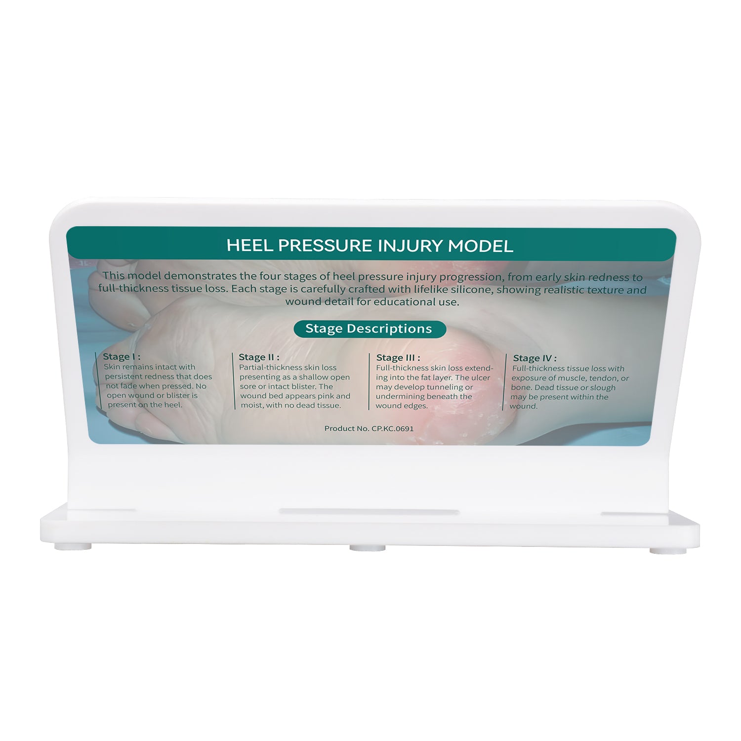 Wound Care Demonstration Heel Pressure Ulcer Model