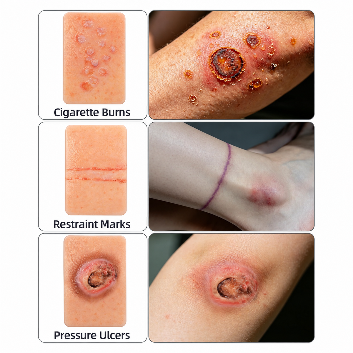 Wound Simulation Kit for Nursing Education