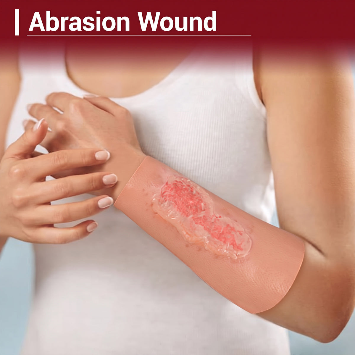 Wearable Abrasion Wound Model for Medical Training