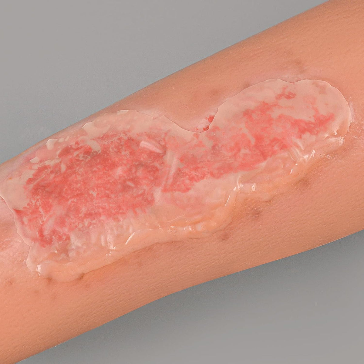Wearable Abrasion Wound Model for Medical Training