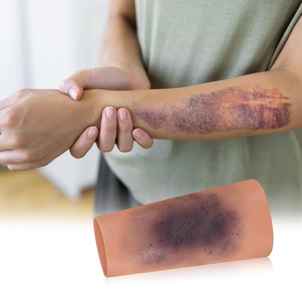 Wearable Bruise Wound Model