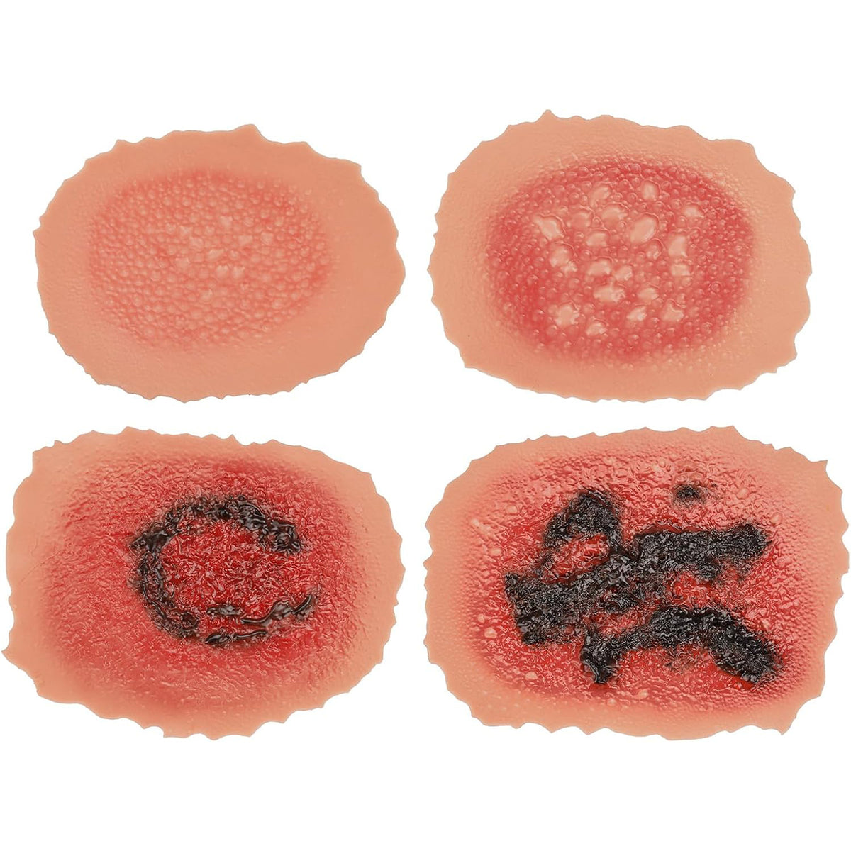 Adhesive Burn Wound Trainer Kit