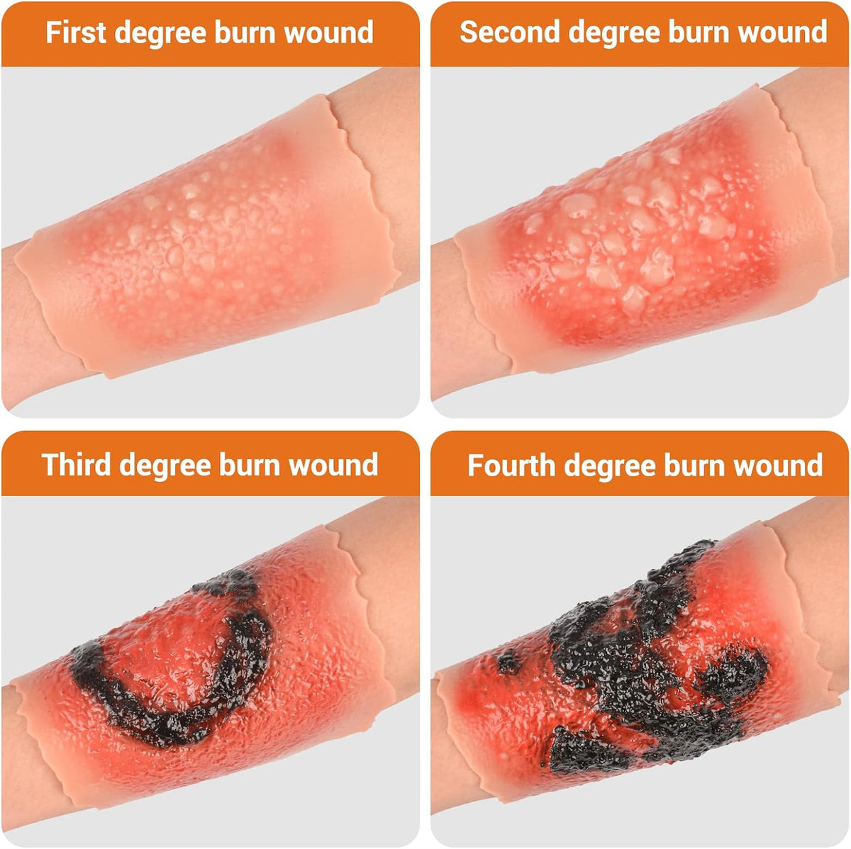 Adhesive Burn Wound Trainer Kit