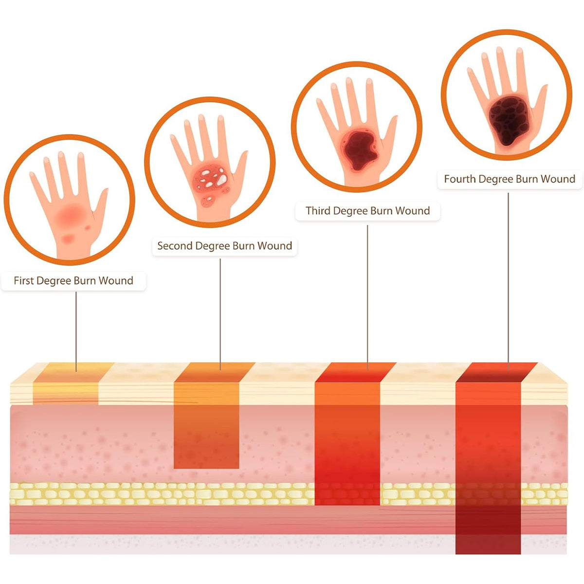 Adhesive Burn Wound Trainer Kit
