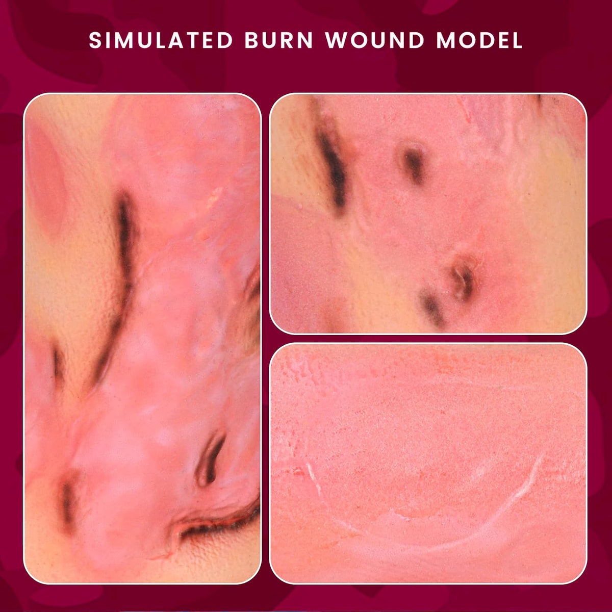 Wearable Lower Leg & Ankle Burn Wound Trainer