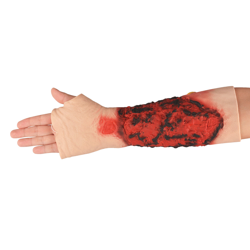 Wearable Forearm Burn Wound Trainer