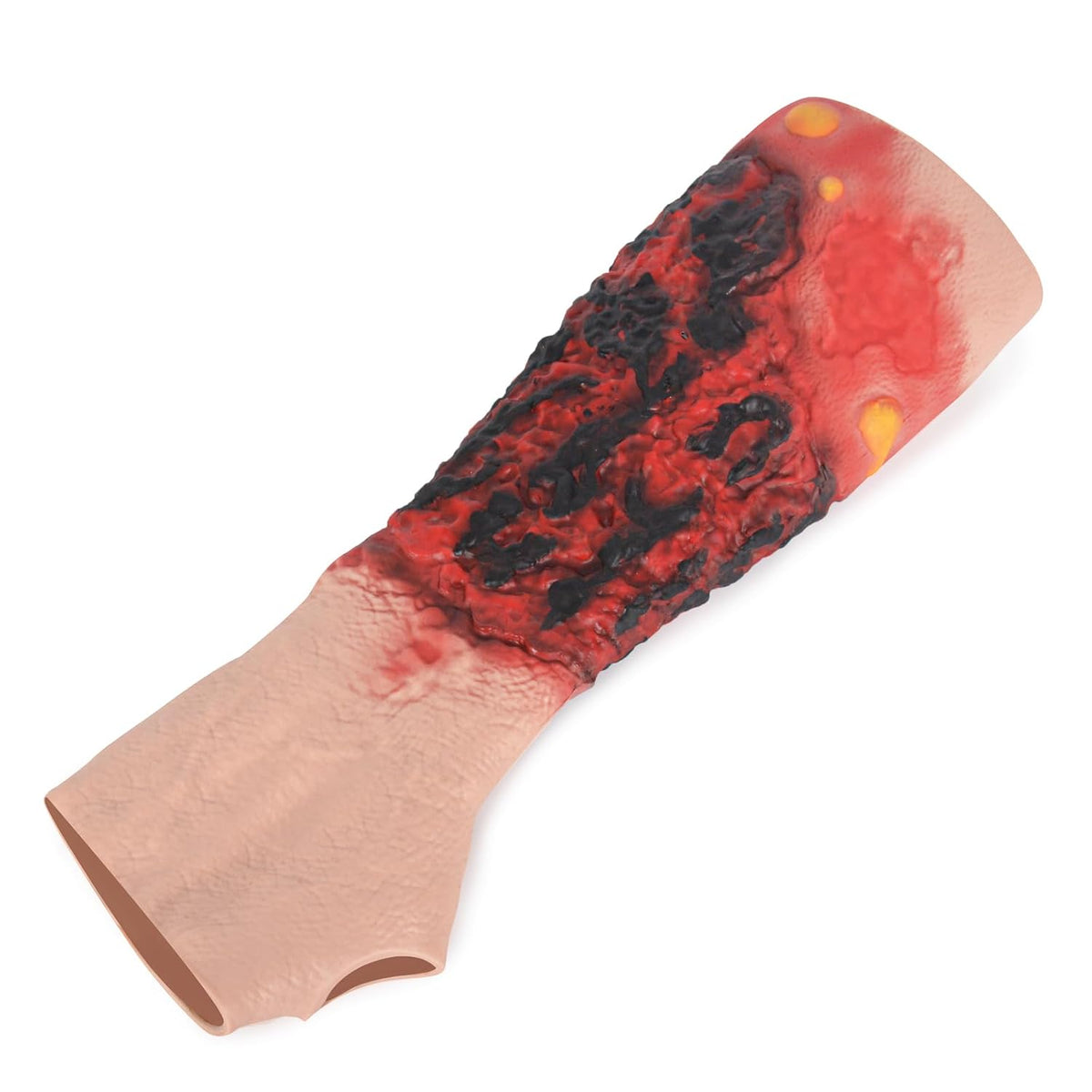 Wearable Forearm Burn Wound Trainer