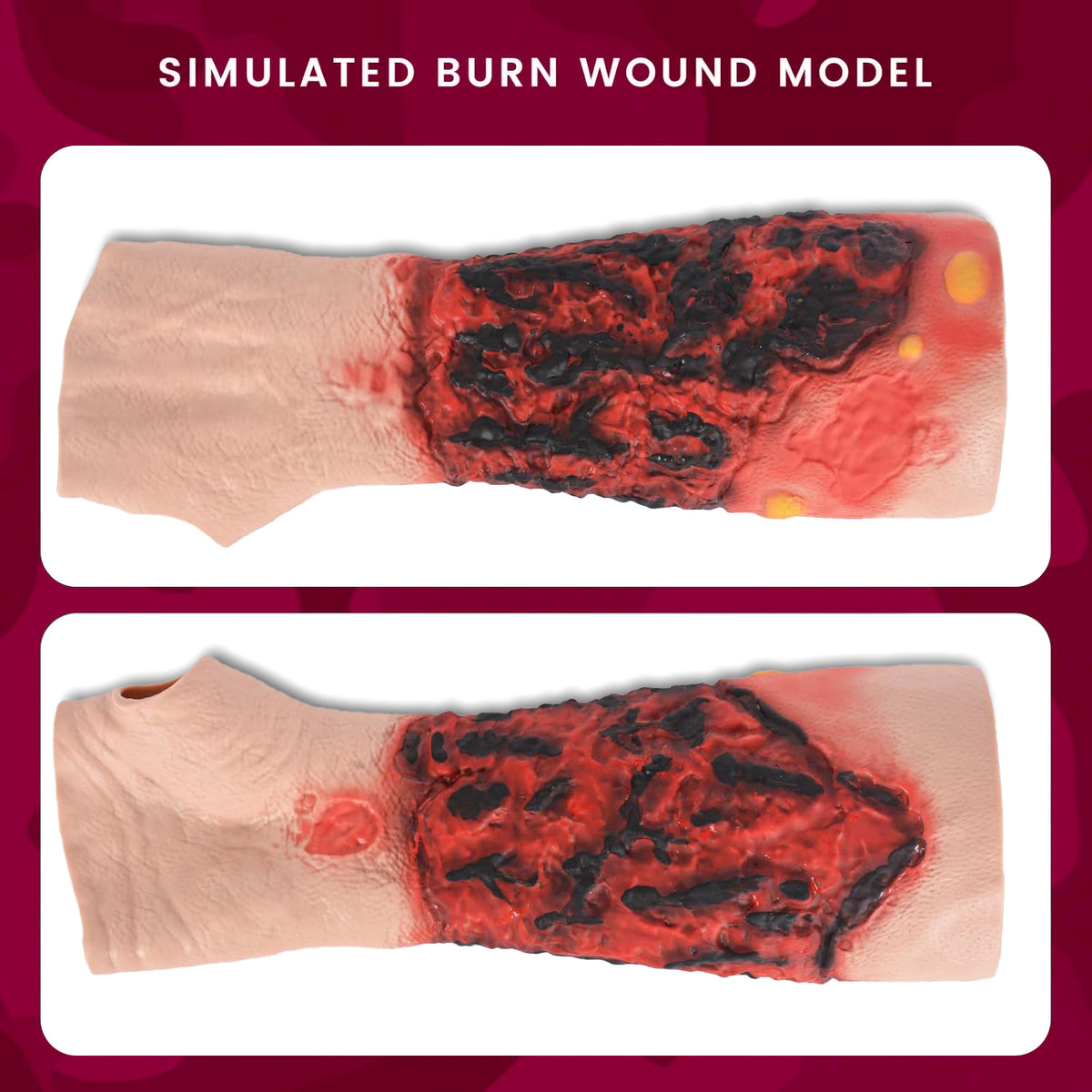 Wearable Forearm Burn Wound Trainer