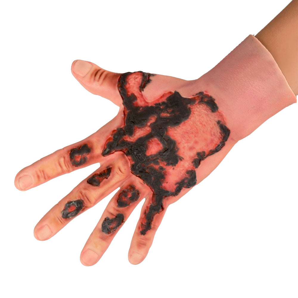 Wearable Hand Burn Wound Trainer