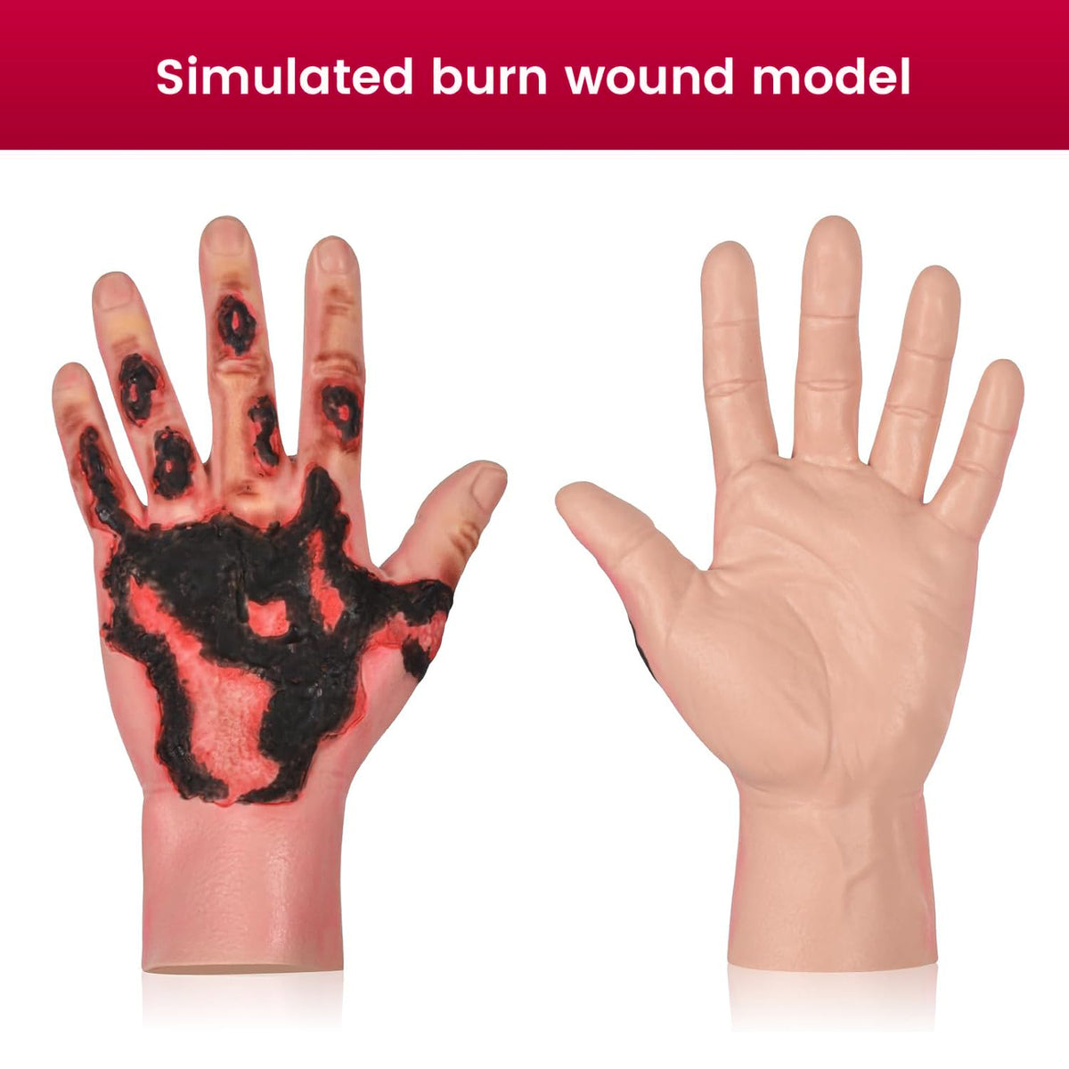 Wearable Hand Burn Wound Trainer