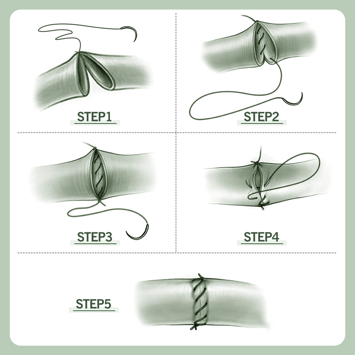 Intestinal Suturing Training Kit