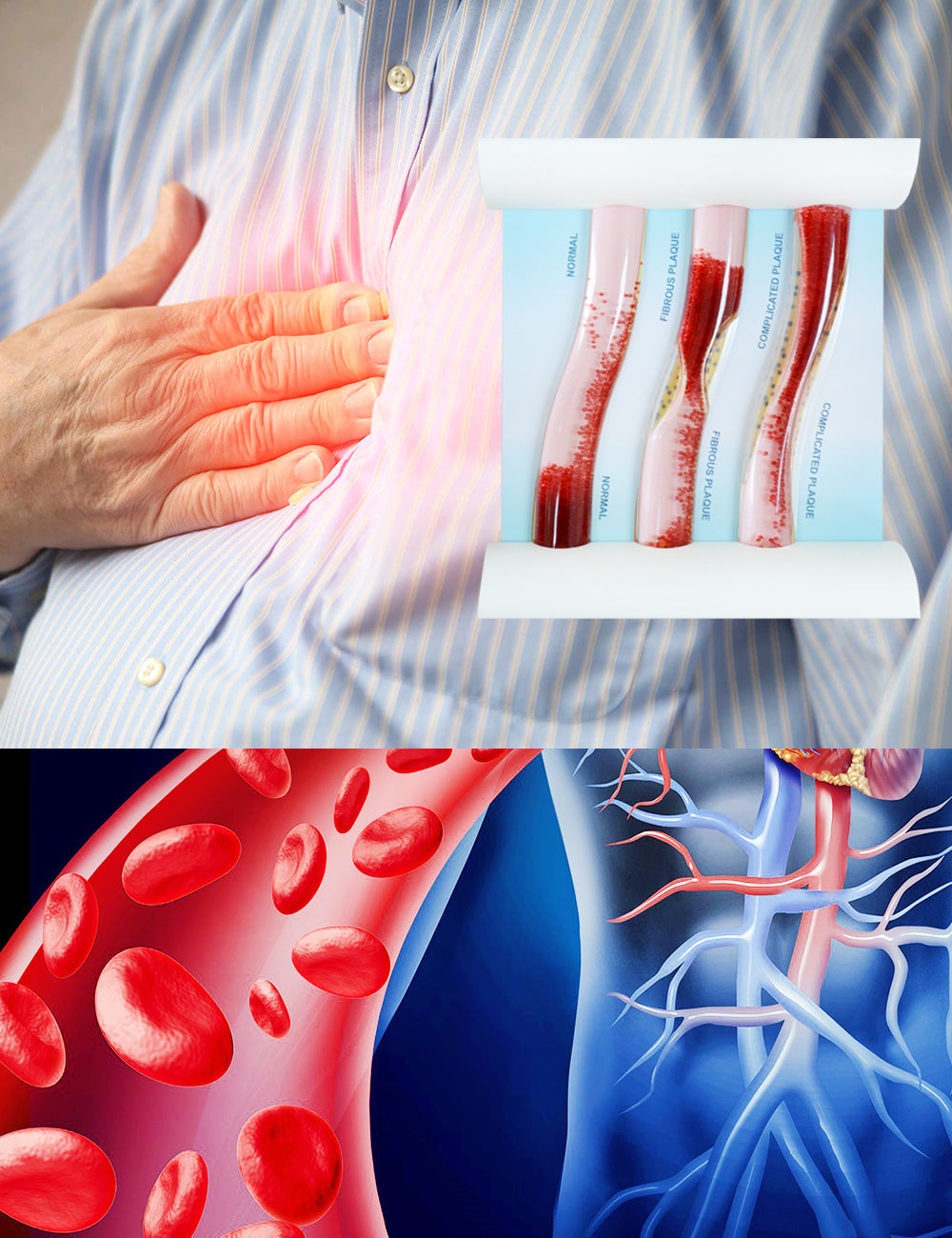 Low-Density Lipoprotein LDL Blood Vessel Model