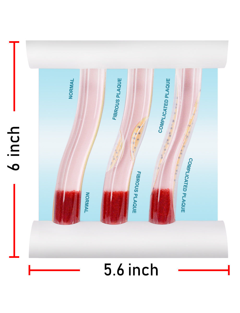 Low-Density Lipoprotein LDL Blood Vessel Model