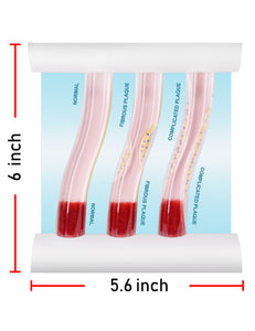 Low-Density Lipoprotein LDL Blood Vessel Model for Medical Patient Doctor Teaching