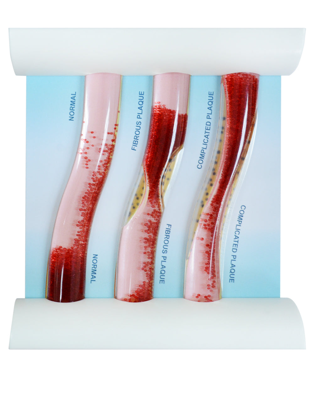 Blood Vessel Model with LDL Simulation 