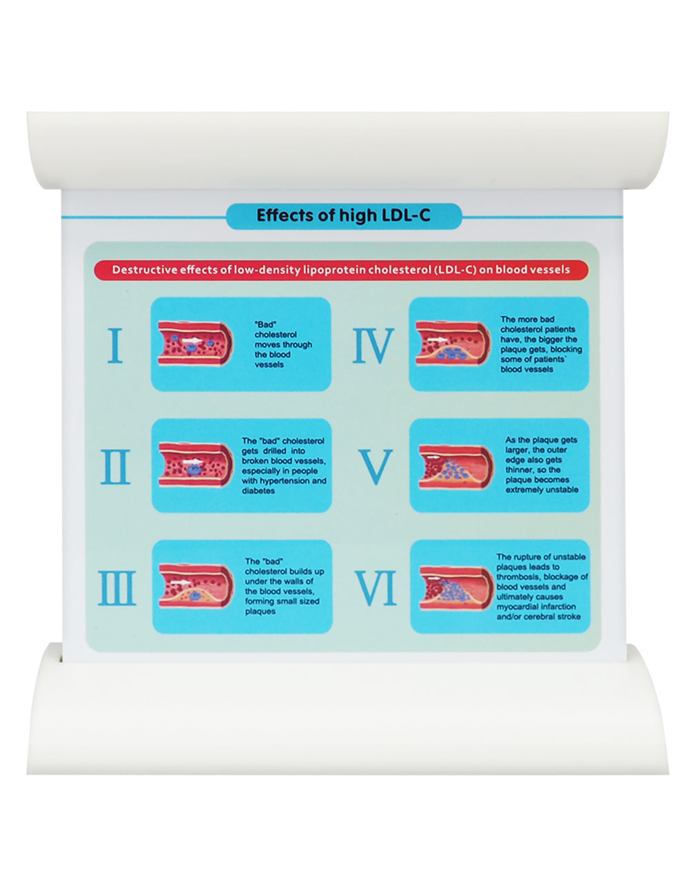 Low-Density Lipoprotein LDL Blood Vessel Model