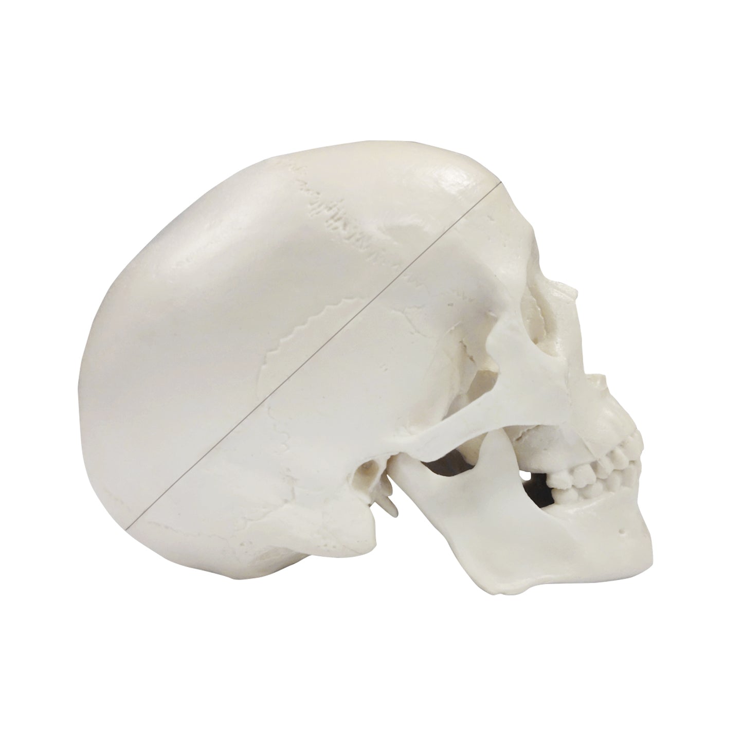 Removable Cranial Cap And Base On Mini Skull Model