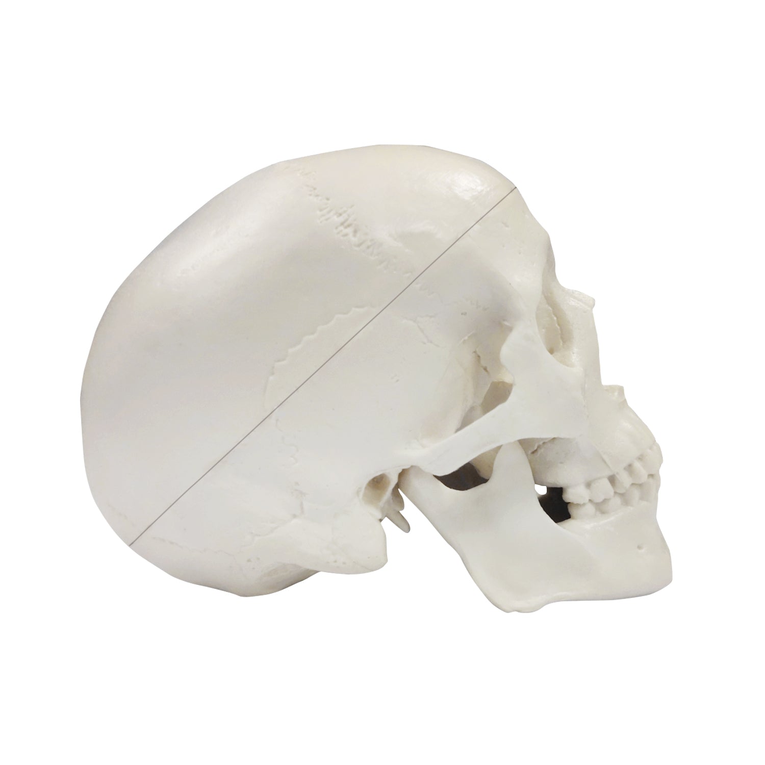 Removable Cranial Cap And Base On Mini Skull Model