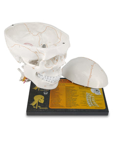 360°Rotatable Upgraded Life Size Human Skull on Cervical Vertebrae Anatomical Model with Spinal Nerves and Arteries with Newest Laser-Etched Fonts for Medical Students