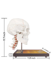 Carregar imagem no visualizador da galeria, 360°Rotatable Upgraded Life Size Human Skull on Cervical Vertebrae Anatomical Model with Spinal Nerves and Arteries with Newest Laser-Etched Fonts for Medical Students - [shop_medarchitect]