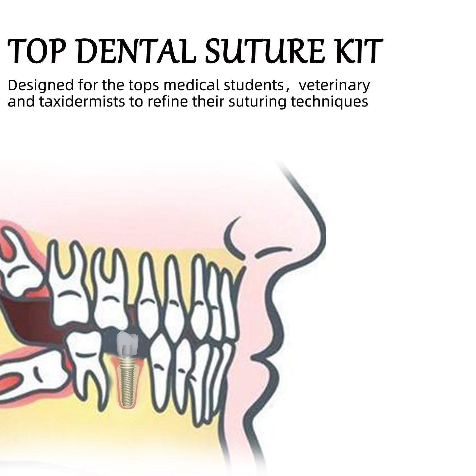 Top Dental Suture Kit