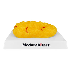 Medarchitect 1 lb Fat Replica Weight Loss Motivation & Reminder for Nutritionist, Science Course for Medical Student